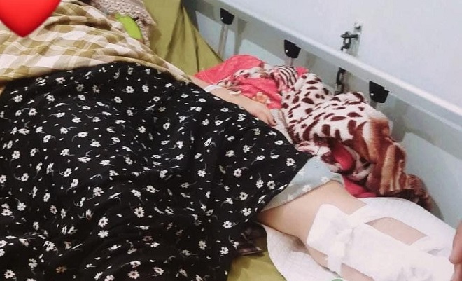 Siswa SMA di Kuansing Dililit Ular Piton Saat Tertidur Lelap