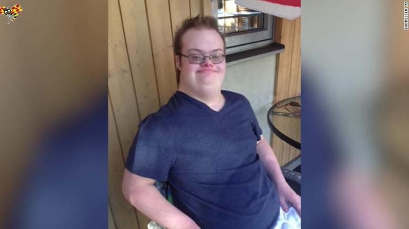 Bawa Pistol Mainan, Pria Down Syndrome Ditembak Mati Polisi Swedia