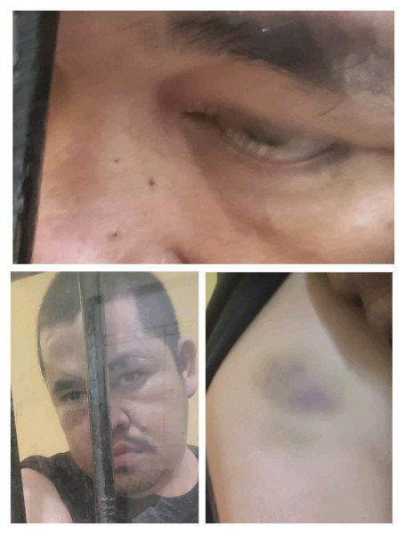 Tahanan Babak Belur di Polres Pelalawan, Ketua KNPI Riau Curiga Polisi Melanggar Prosedur