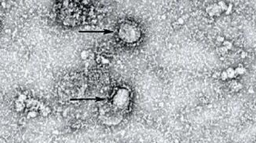 China Akui Kewalahan Hadapi Virus Corona
